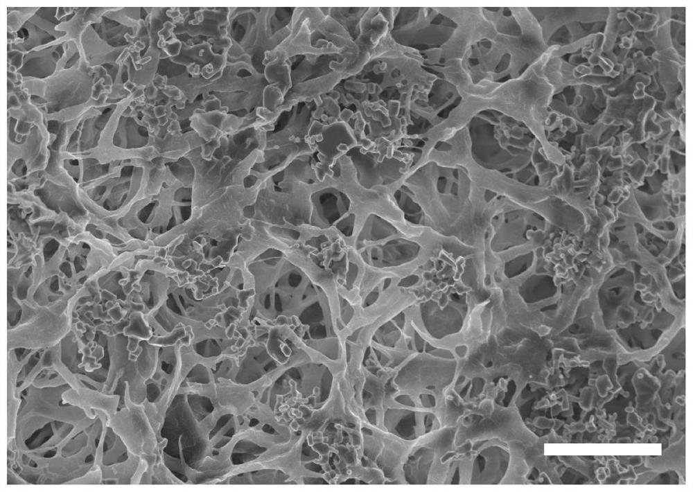 Micro-nano double-layer structure antibacterial stent as well as preparation method and application thereof