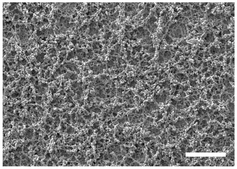 Micro-nano double-layer structure antibacterial stent as well as preparation method and application thereof