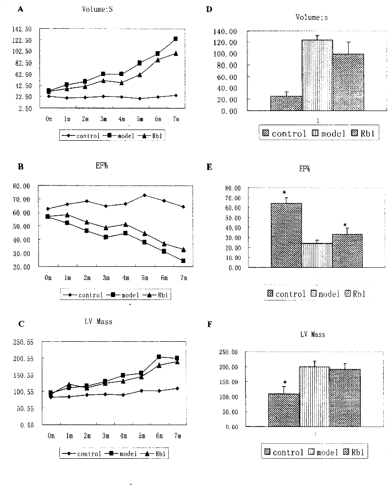 Use of ginsenoside Rb1 in preparing medicine for treating dilated cardiomyopathy