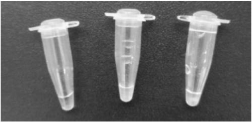 Primer set and kit for detecting Ureaplasma urealyticum through loop-mediated isothermal amplification method