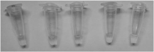 Primer set and kit for detecting Ureaplasma urealyticum through loop-mediated isothermal amplification method