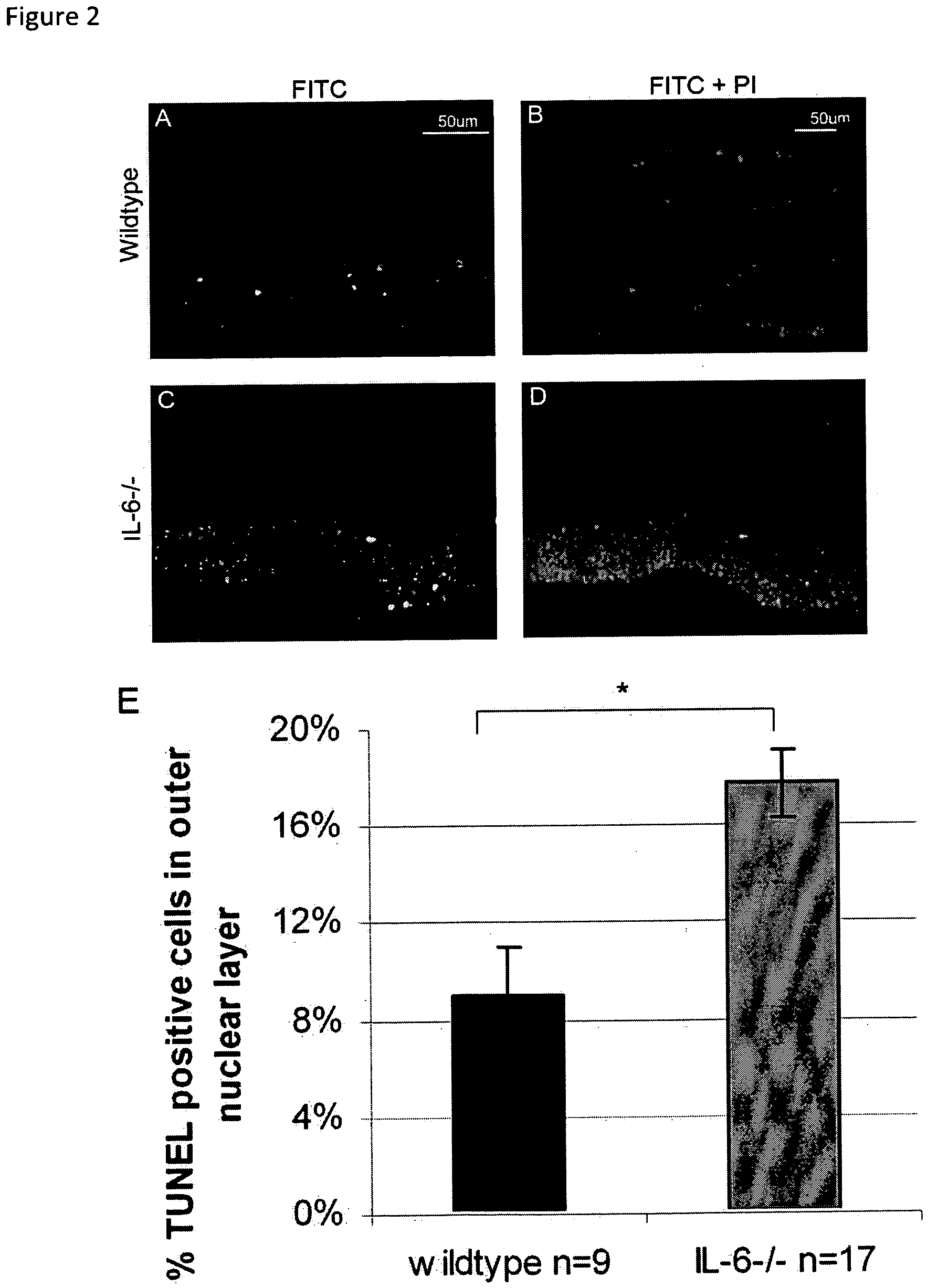 Compositions and methods for detecting and treating ophthalmic disorders