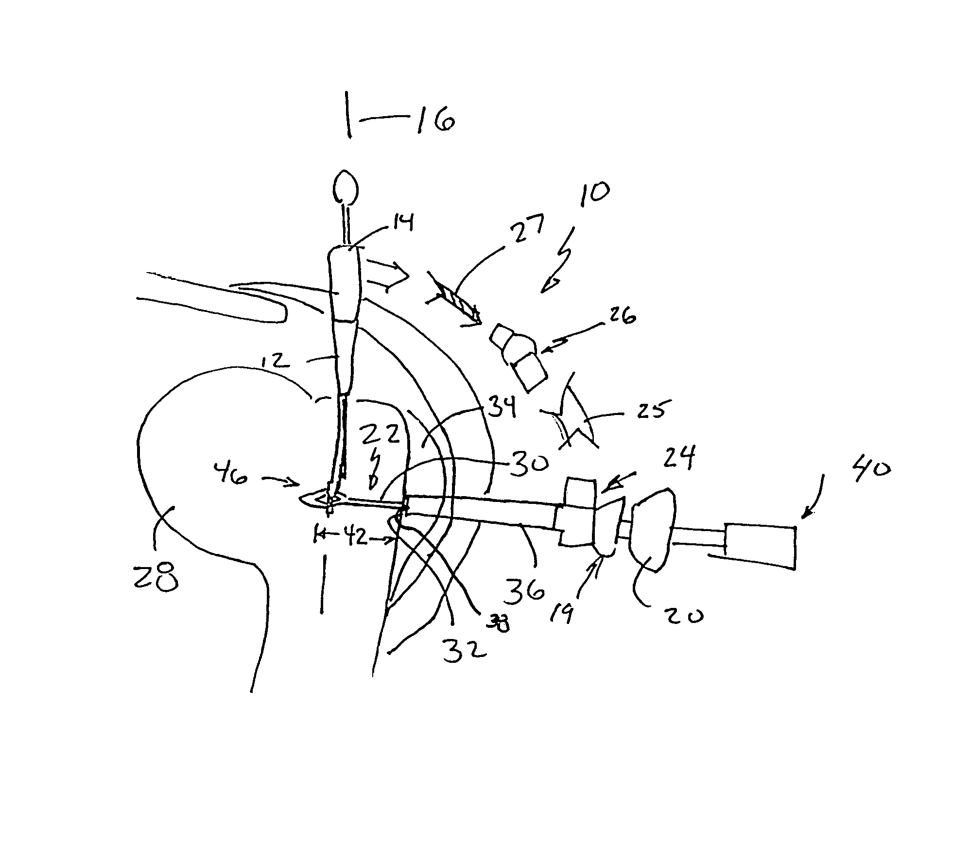 Surgical drill guide with awl and method of use