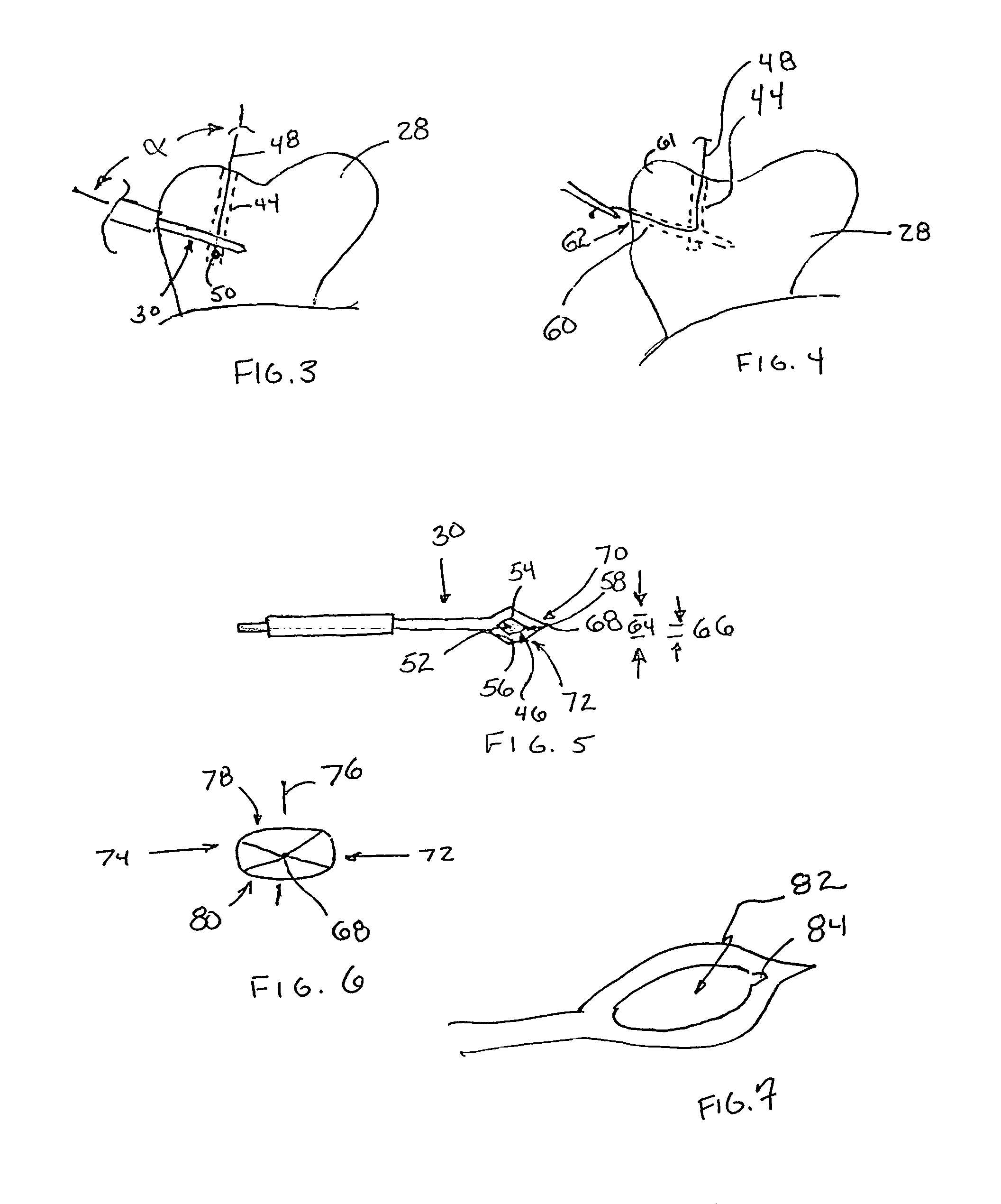 Surgical drill guide with awl and method of use