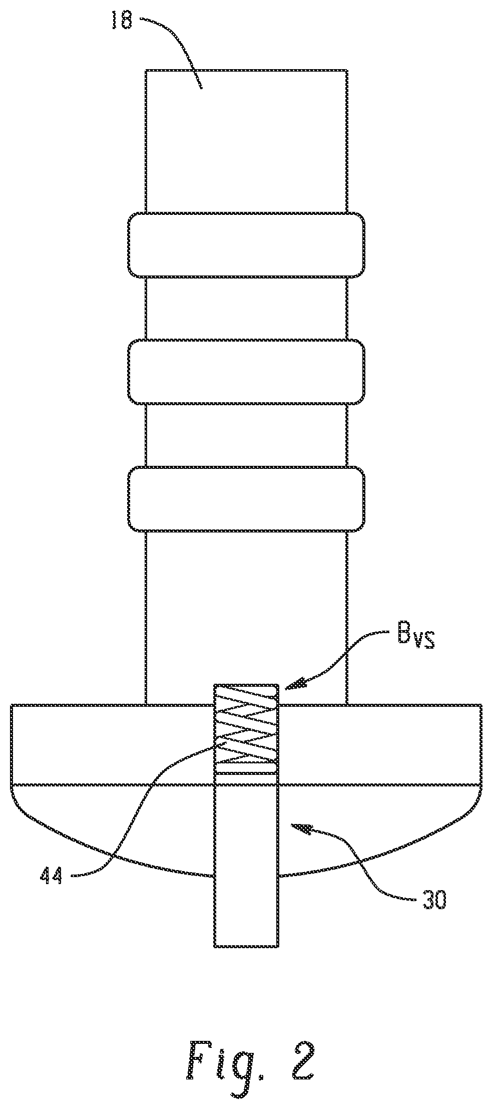 Low torque residential water shutoff valve