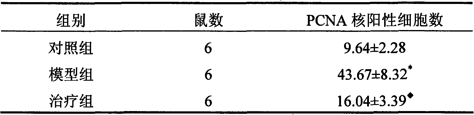 Application of Huaiqihuang particle compound preparation in kidney disease treatment