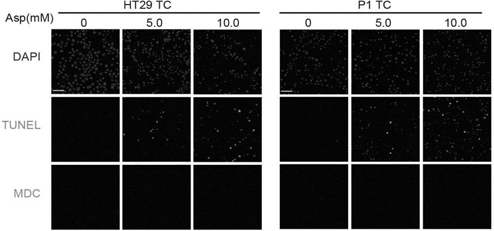 Application of FasL protein serving as biomarker to qualitative Aspirin sensitivity detection of colorectal cancer stem cell