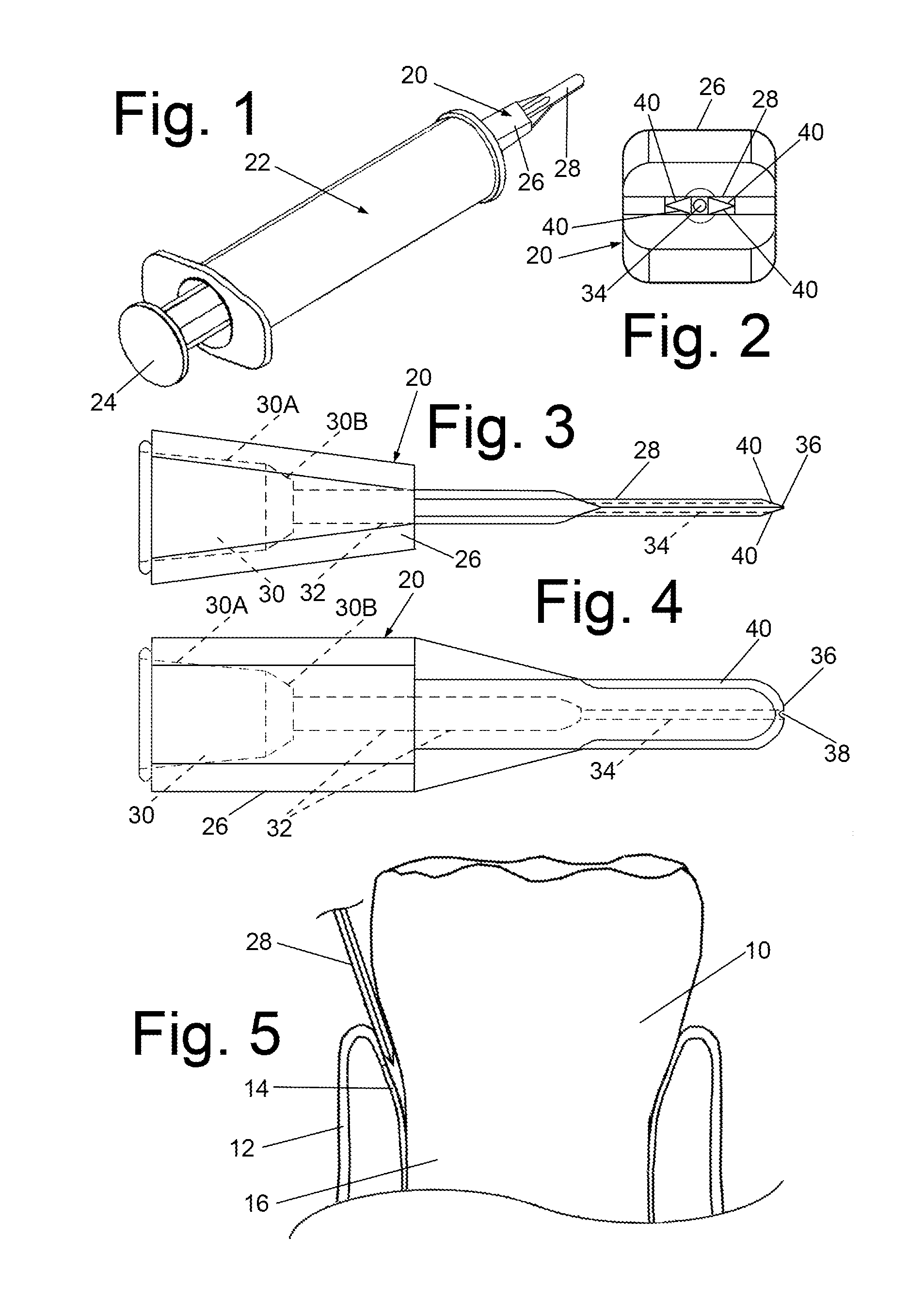 Articulating applicators/injectors for administration of liquid anesthetic and other liquids