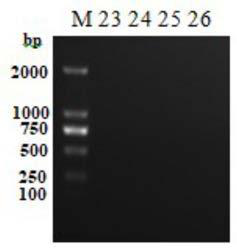 Multiple PCR detection kit for Listeria monocytogenes and Listeria illichii