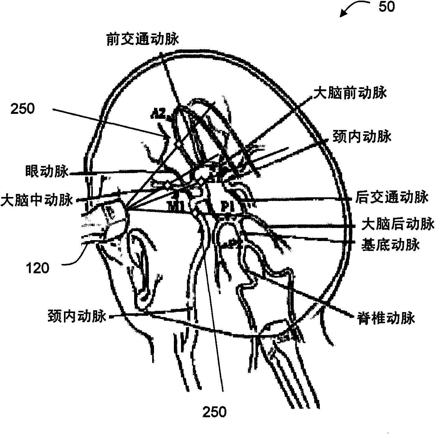 Method and system for imaging vessels