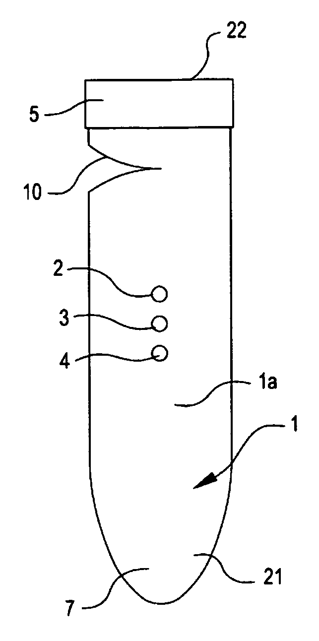 External venous valve stents for the correction of incompetent venous valves