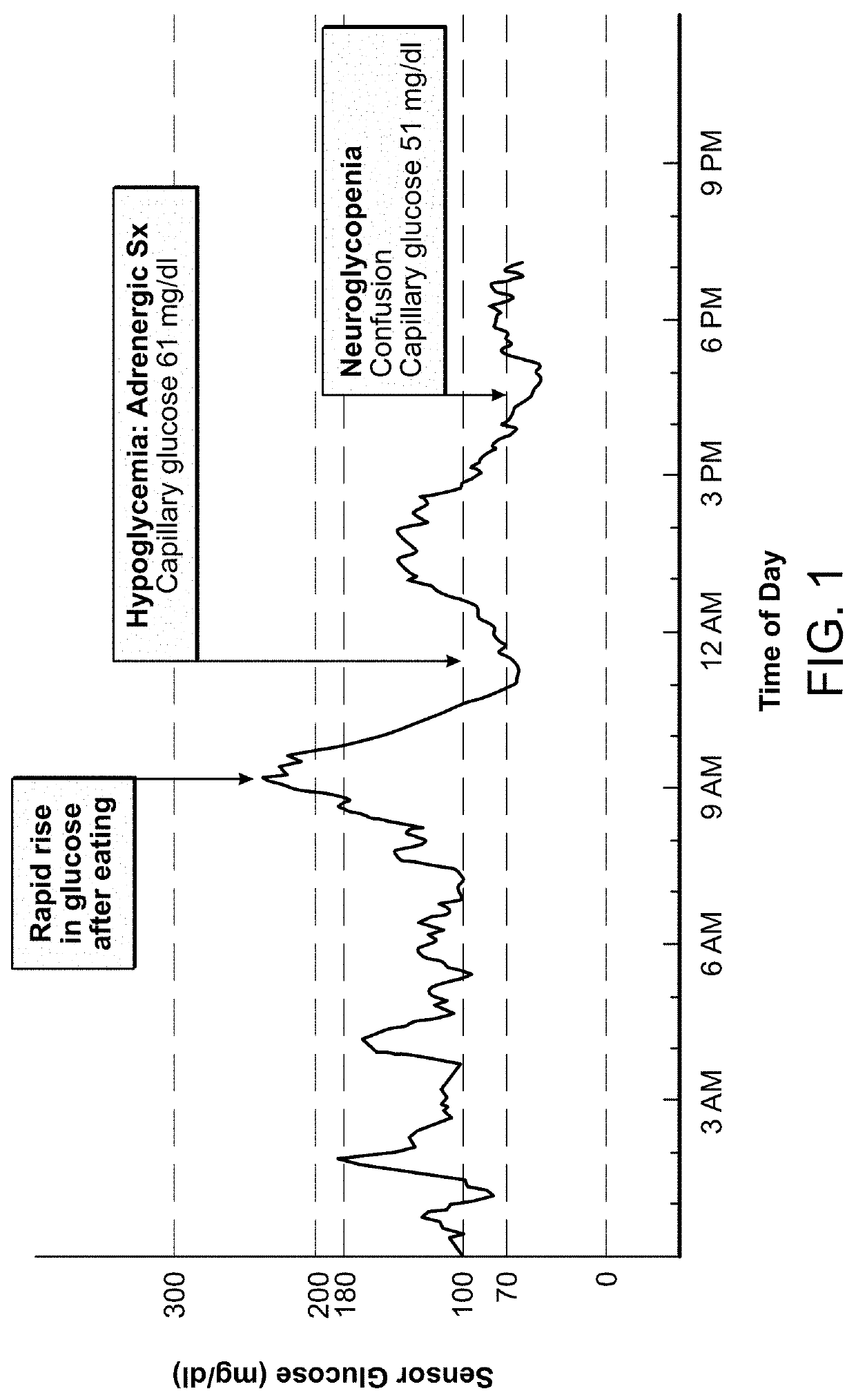 Methods and compositions for treating hypoglycemia