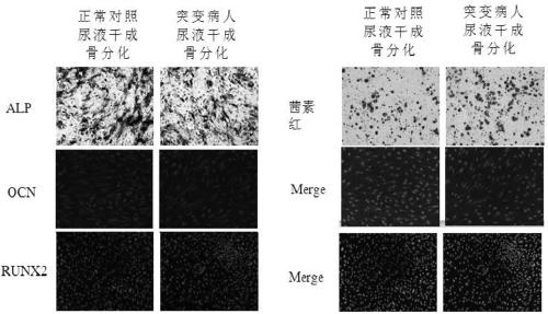 Preparation method and application of normal stem cells separated and cultured from urine of mitochondria mt3243AG mutation groups