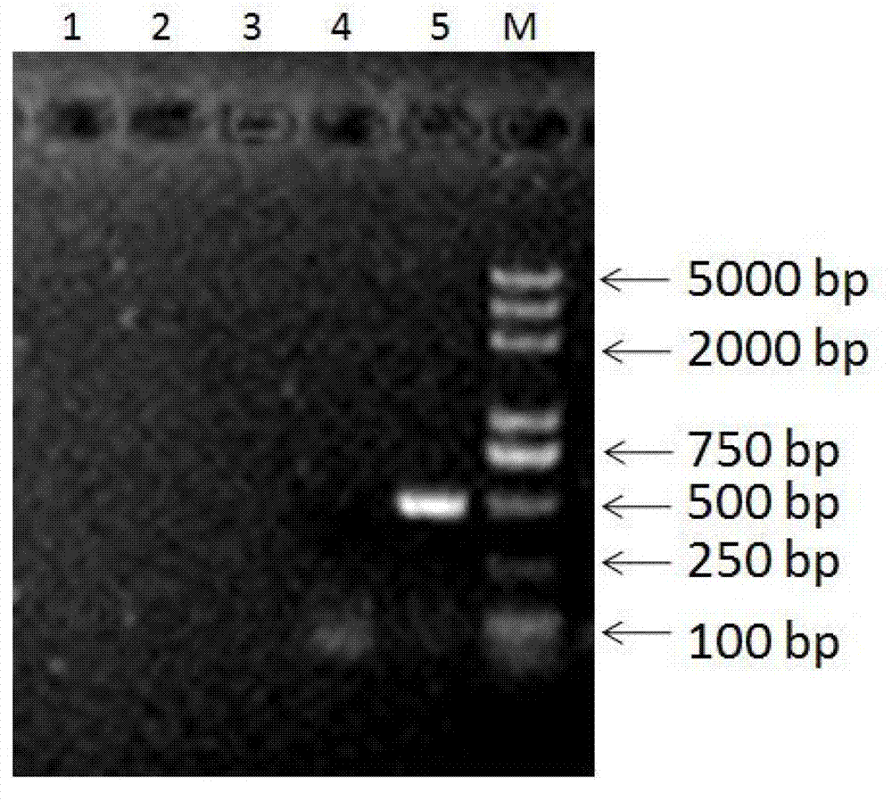 Primer pair for detecting pigeon torque teno viruses and application of primer pair