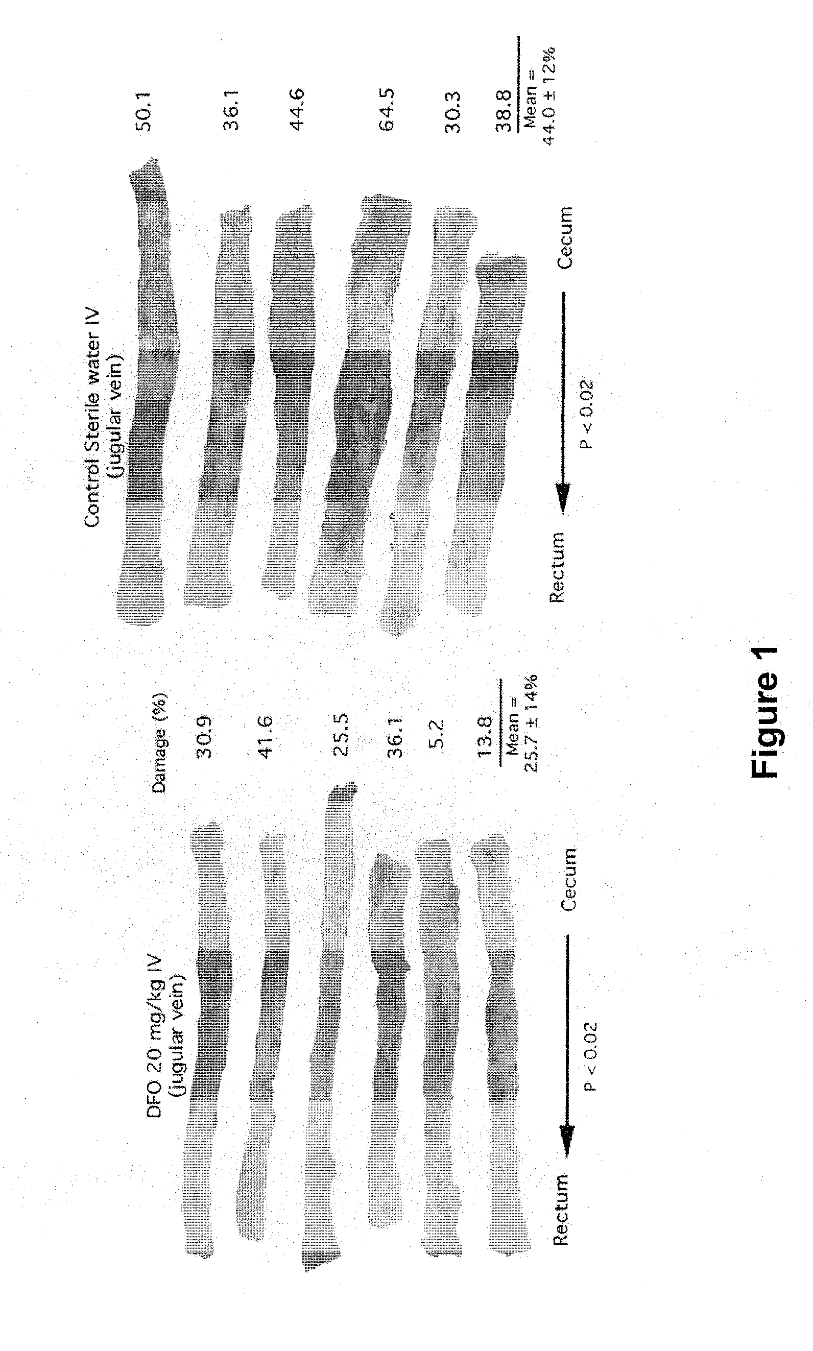 Uses of 3'-desferrithiocin analogs