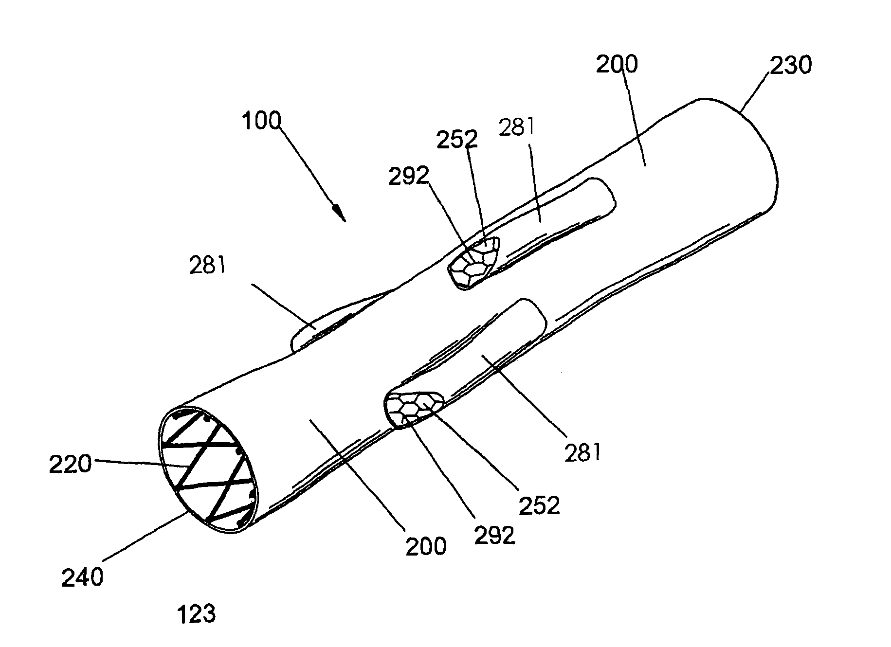 Method of deploying a bifurcated side-access intravascular stent graft
