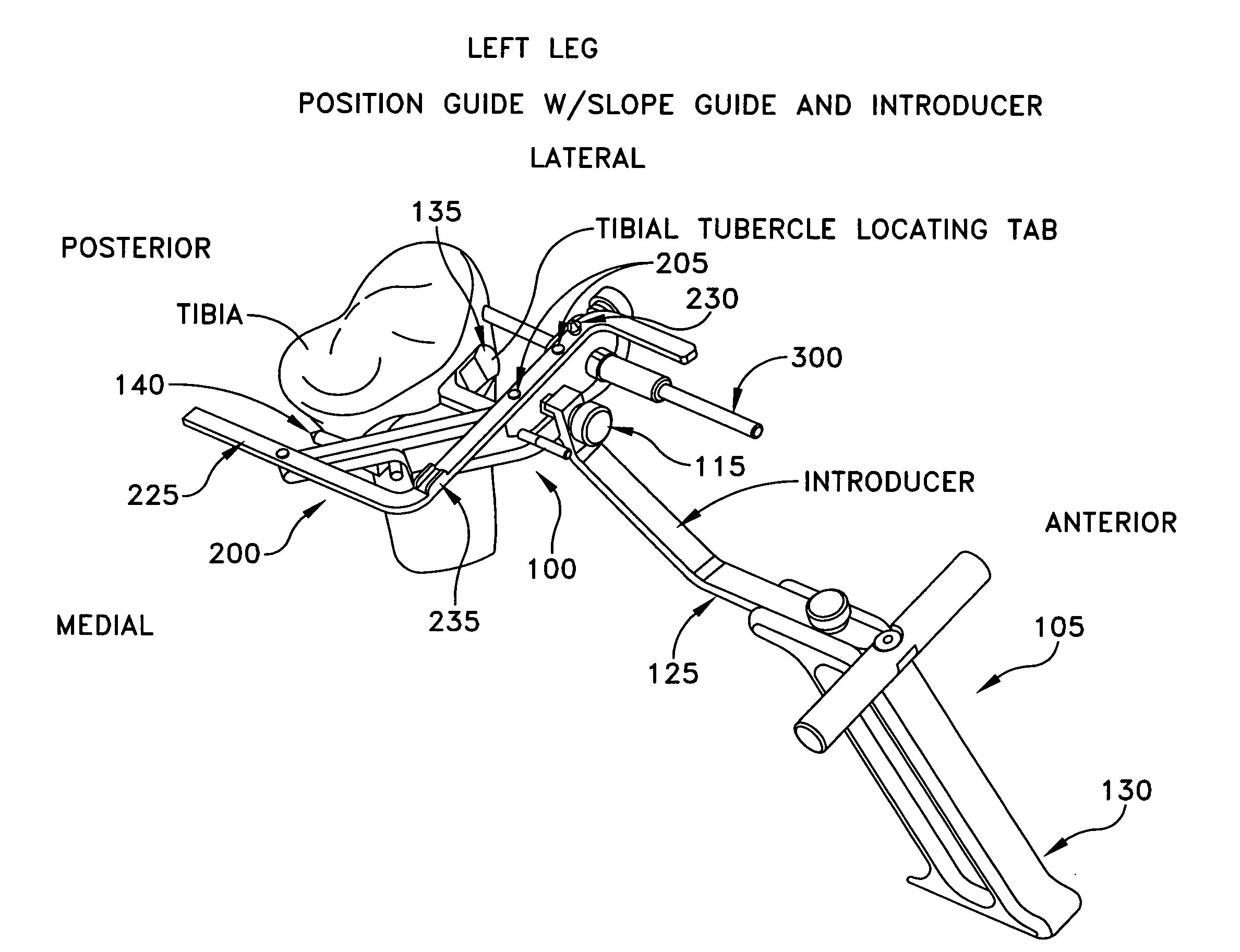 Method and apparatus for performing an open wedge, high tibial osteotomy