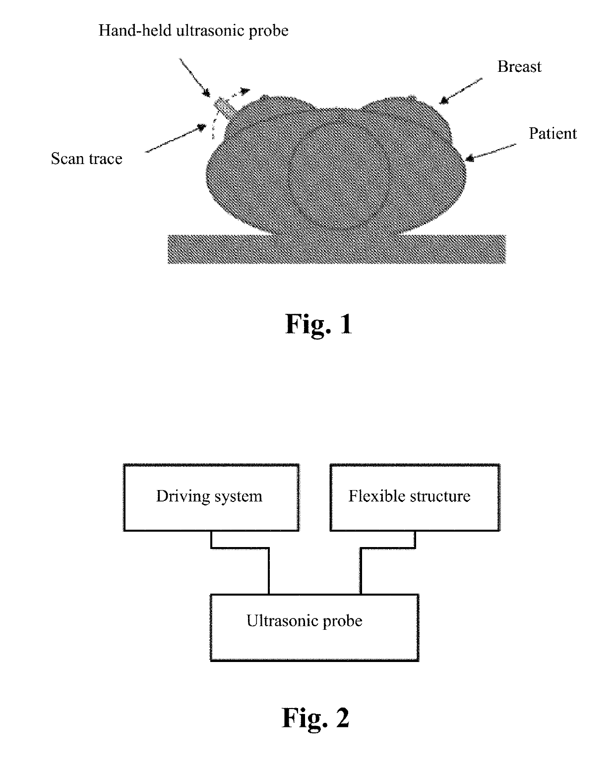 Fully automatic ultrasonic scanner and scan detection method