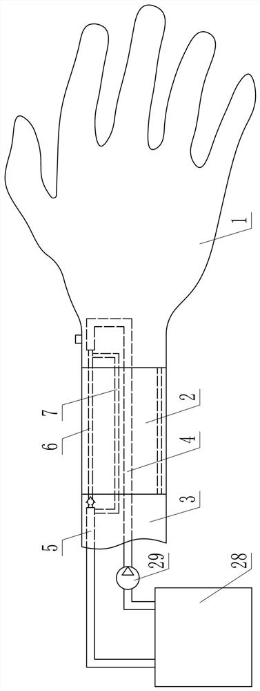 An intravenous injection simulation teaching device