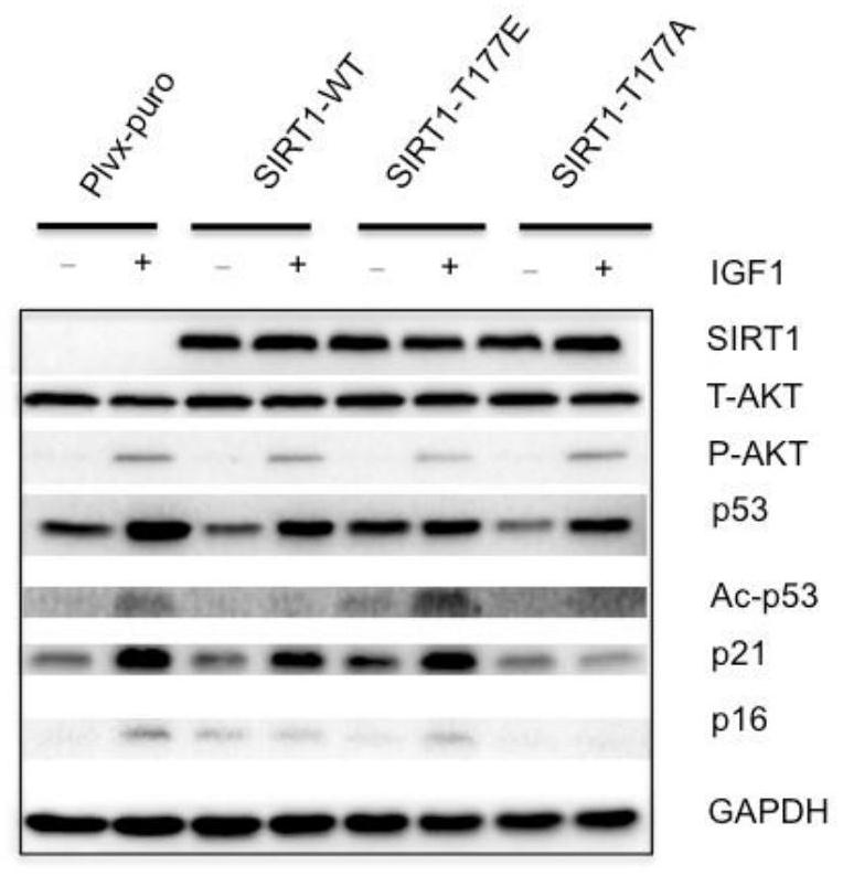 Sirt1-T177 site phosphorylation as a biomarker in aging-related diseases