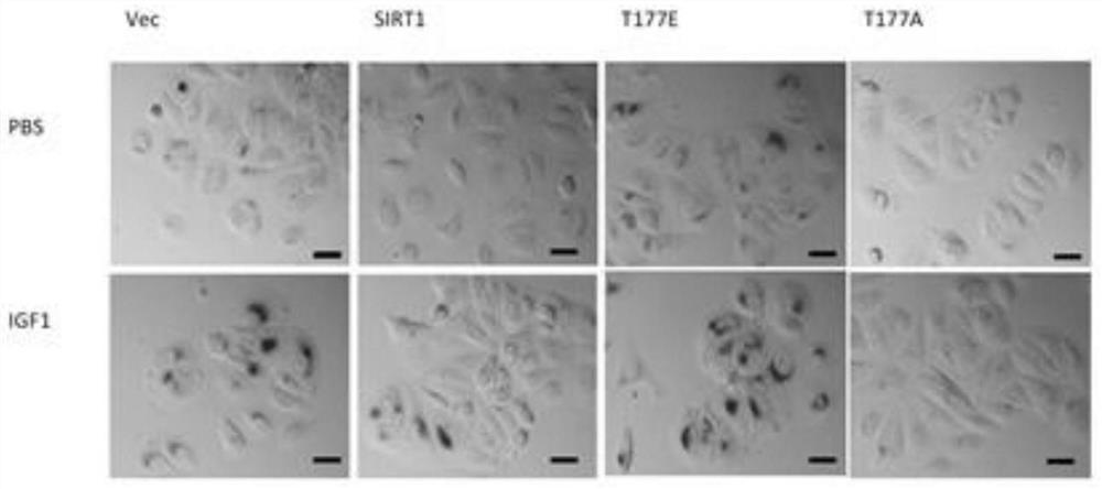 Sirt1-T177 site phosphorylation as a biomarker in aging-related diseases