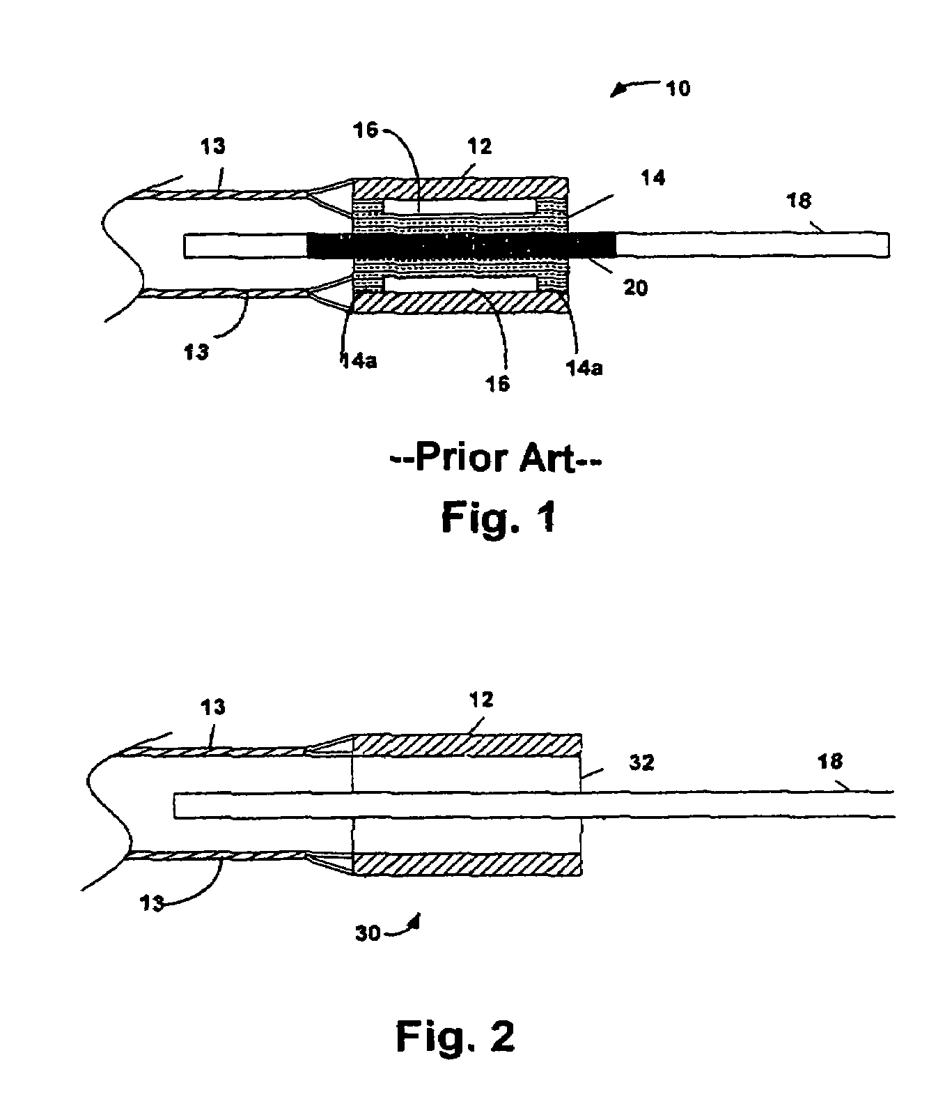 Ultrasonic transducer