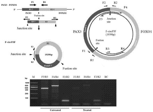 Kit and method for detecting F-circP3F in rhabdomyosarcoma