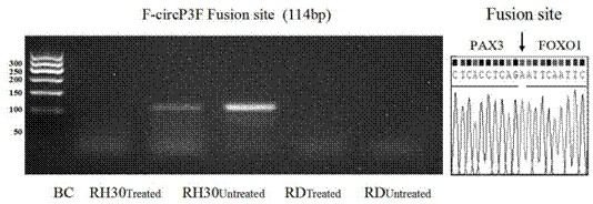 Kit and method for detecting F-circP3F in rhabdomyosarcoma
