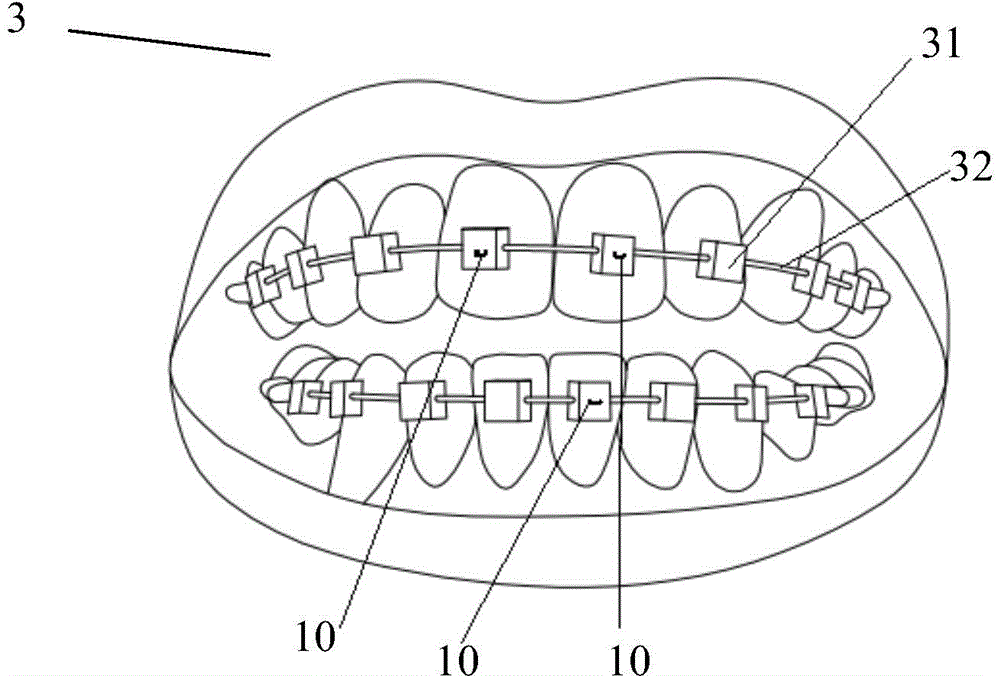 Dental instrument system with sensor