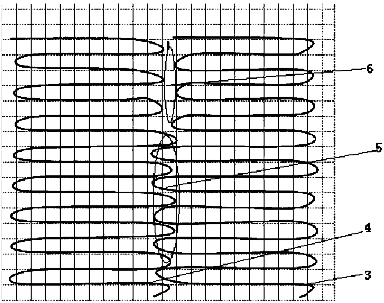 Tensile deformation mesh braid