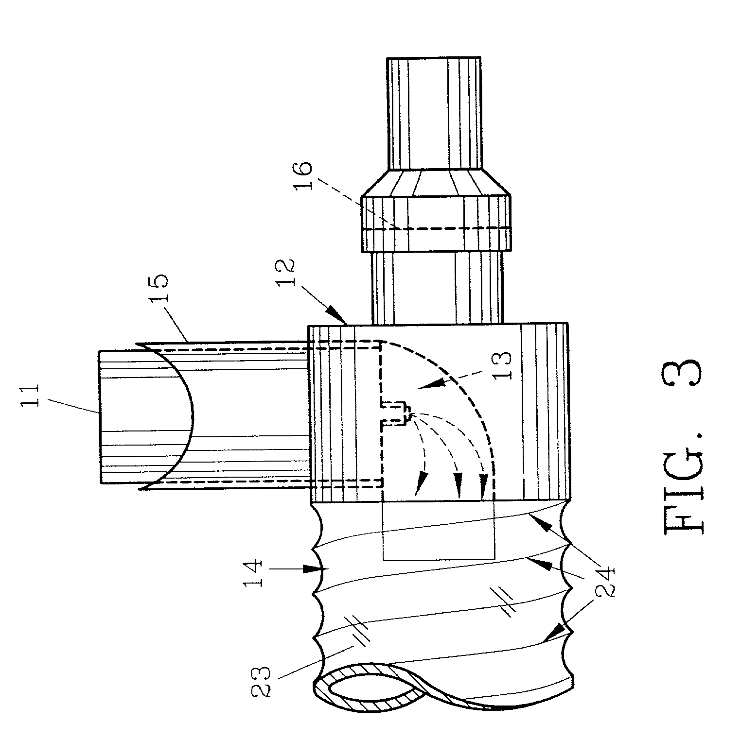 Inhalation therapy assembly and method