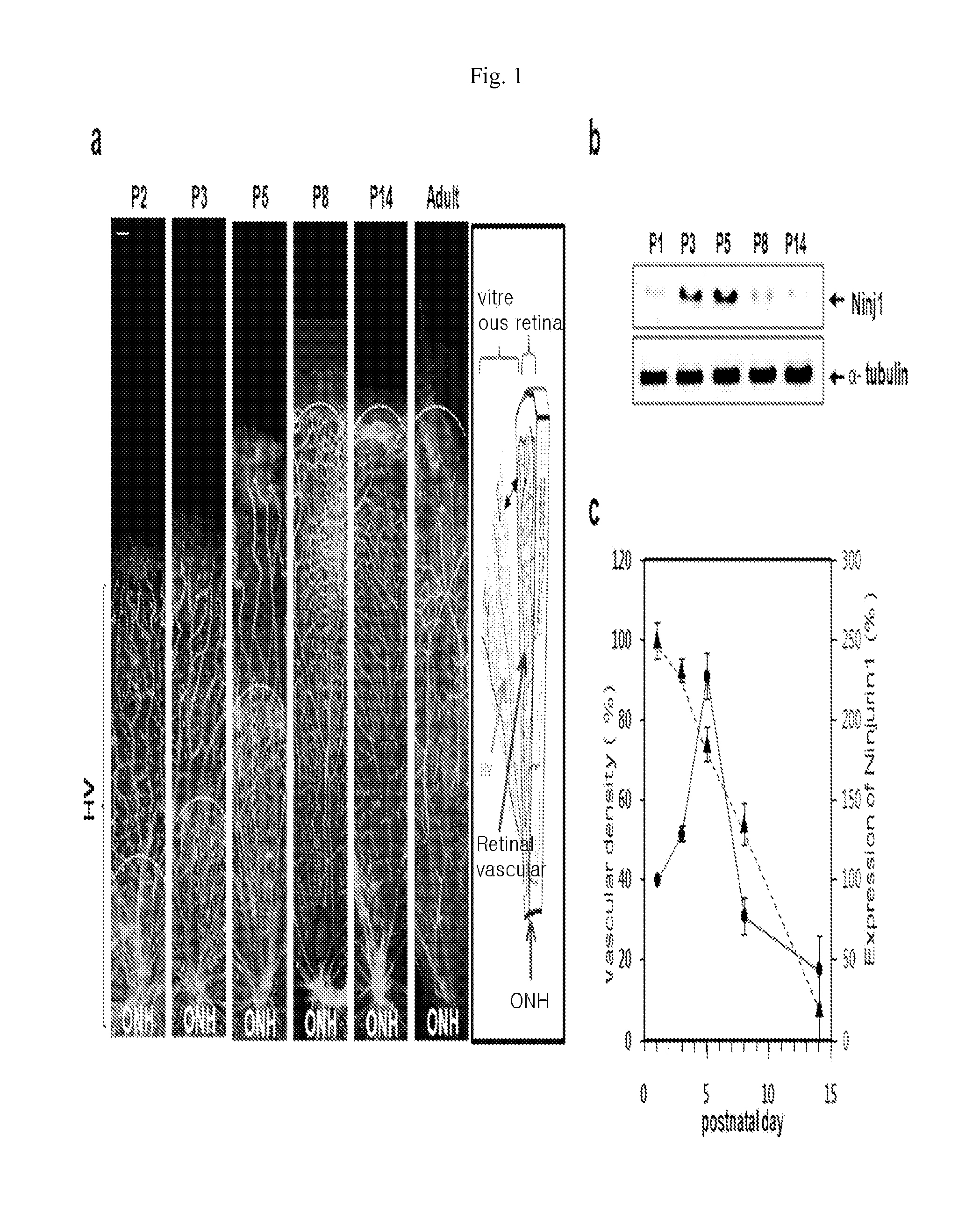 Composition comprising expression or activity inhibitors of ninjurin1 for the prevention and treatment of inflammatory disease