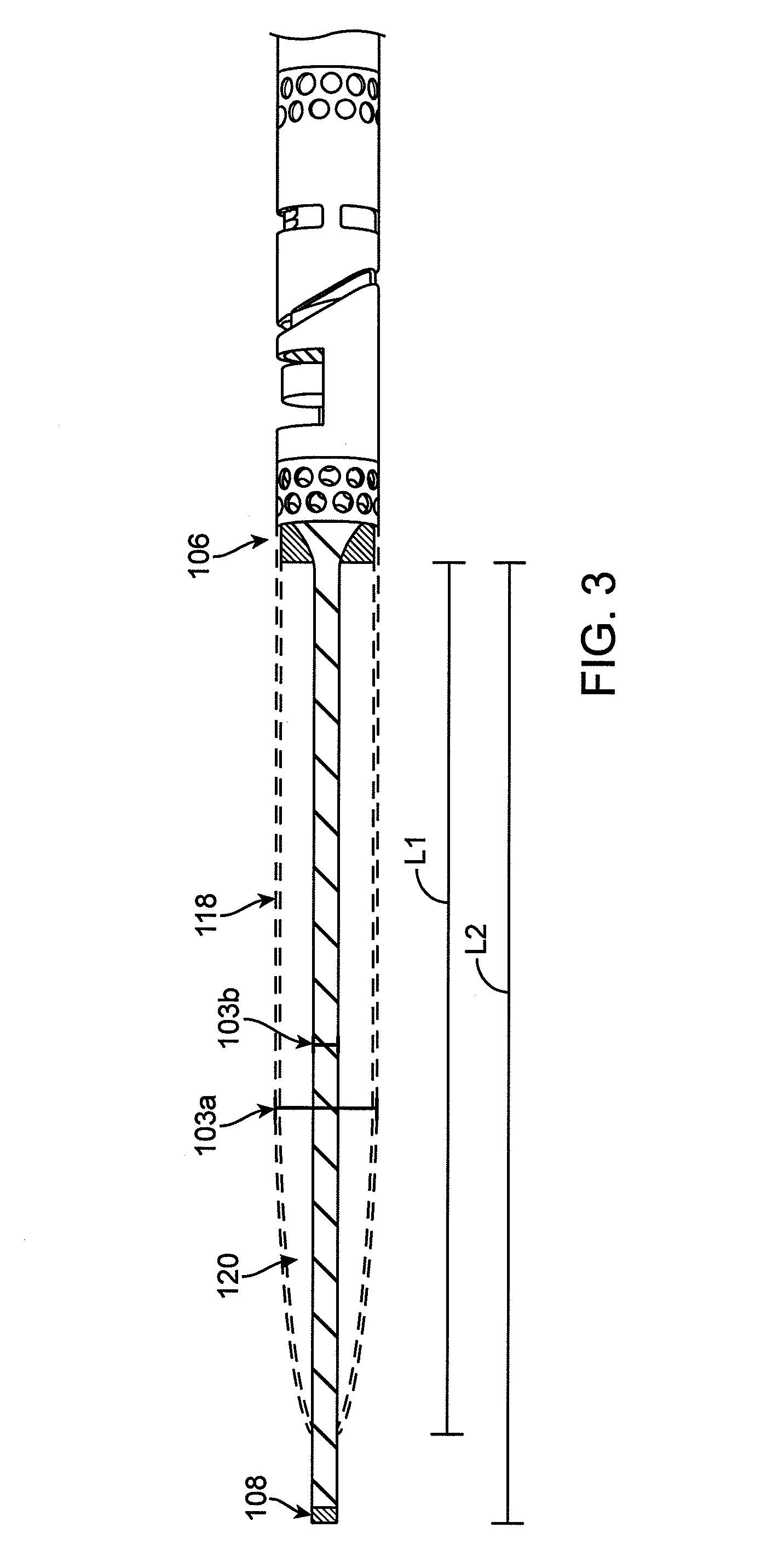 Tissue collection device for catheter
