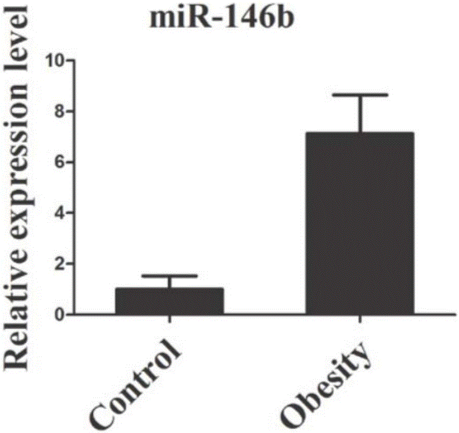 Serum or plasma miRNA marker related to diabetes mellitus type 2 and application thereof