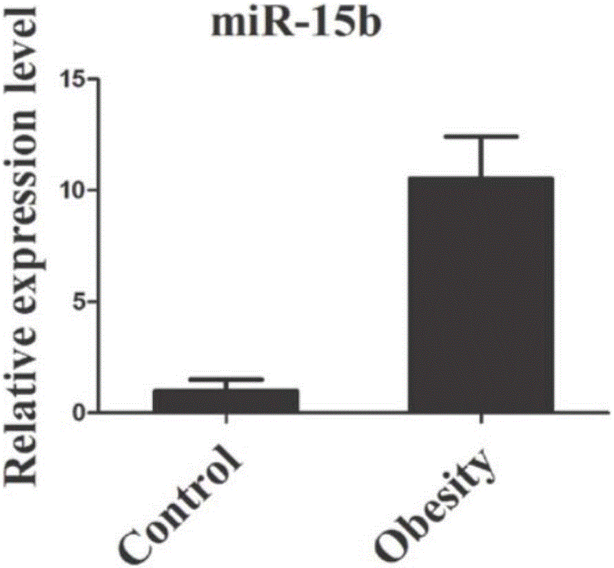 Serum or plasma miRNA marker related to diabetes mellitus type 2 and application thereof