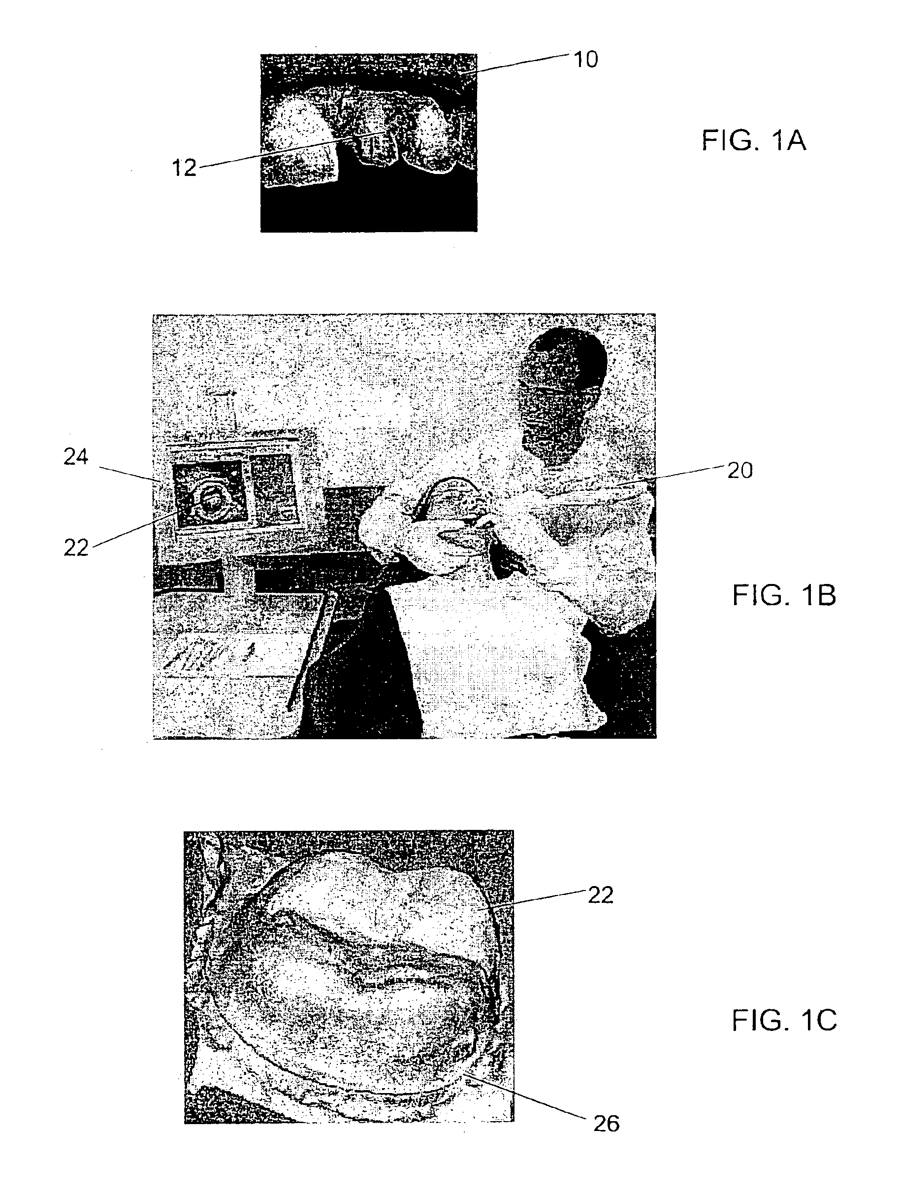 Method and system for fabricating a dental coping, and a coping fabricated thereby