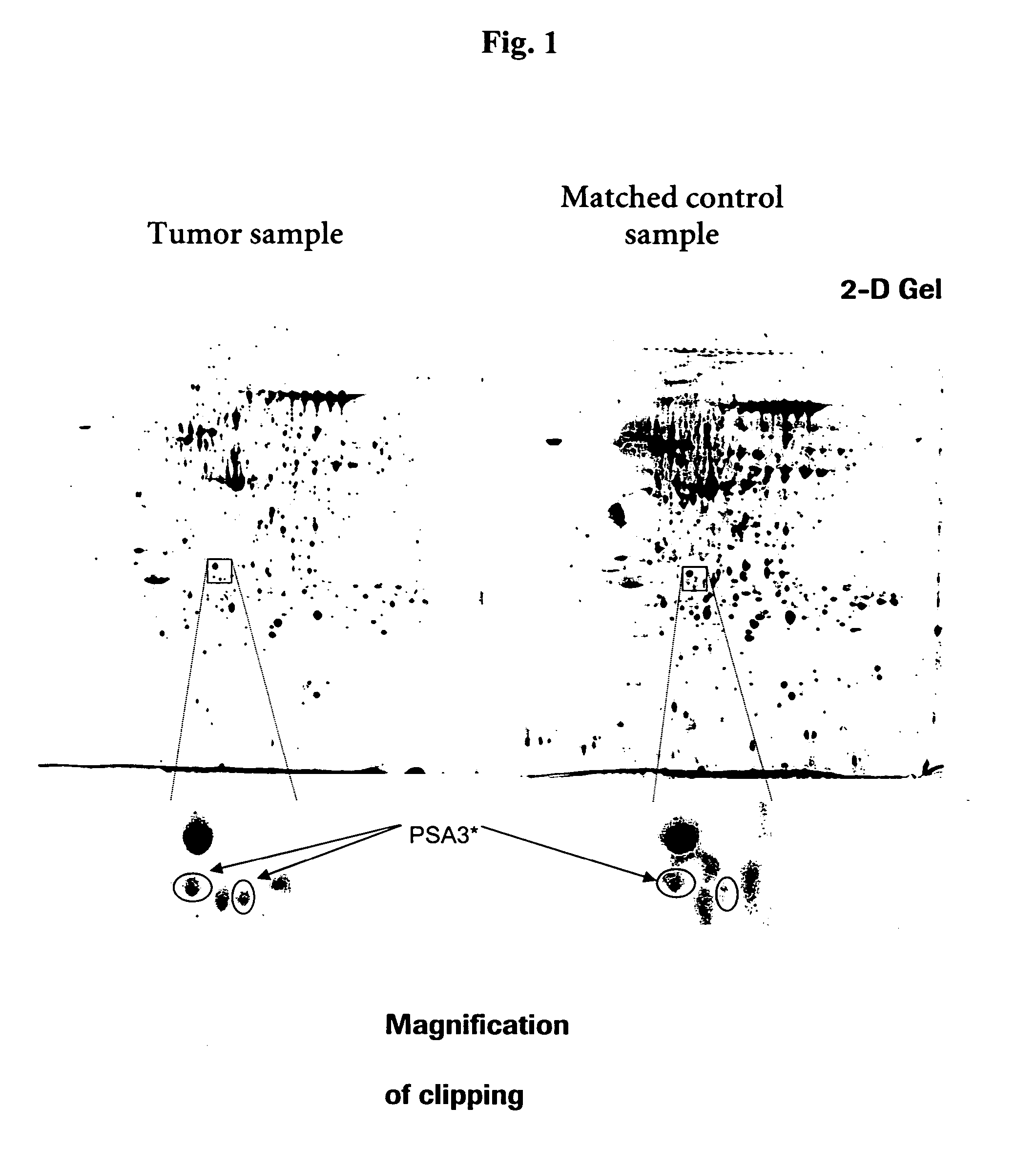 Use of protein PSA3 as a marker for colorectal cancer