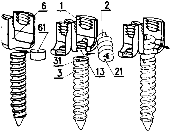 Flexible pedicle screw