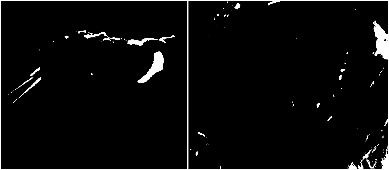 Post-operation absorbable anti-adhesion material for cardiac surgery and film prepared from material