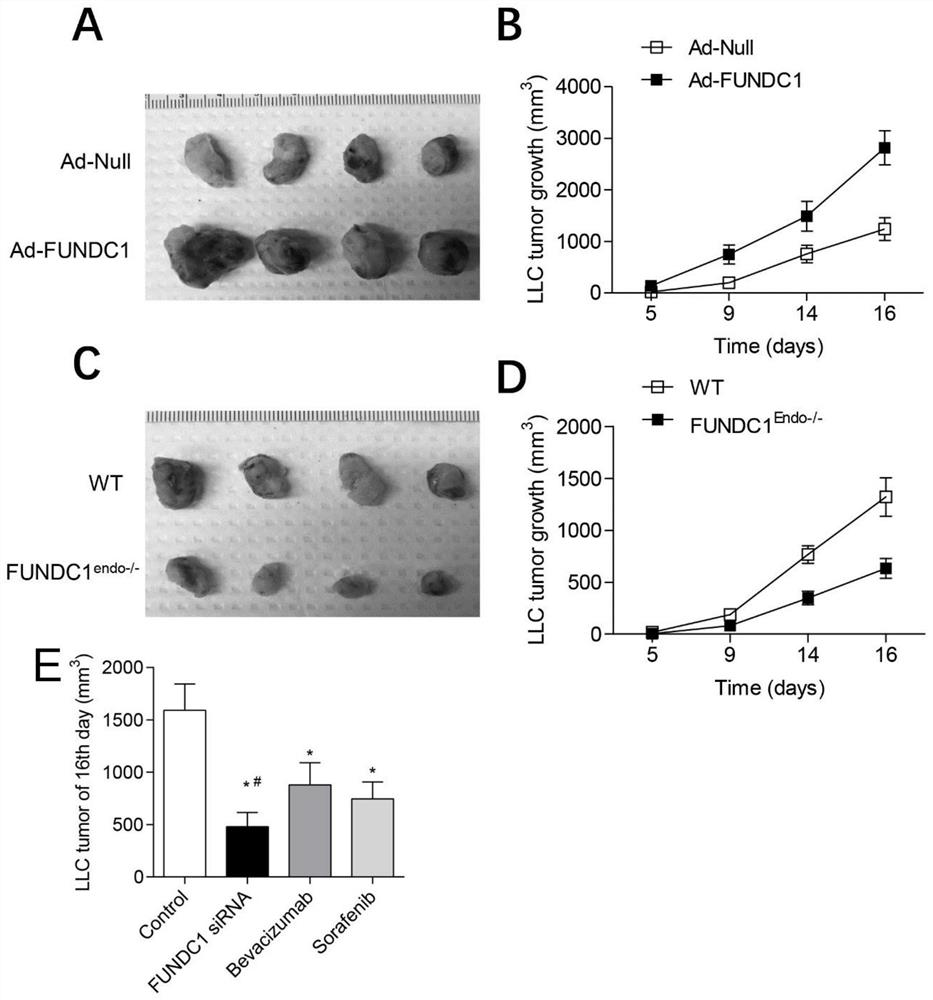 Application of FUNDC1 in preparation of medicine for preventing and treating vascular and tumor diseases