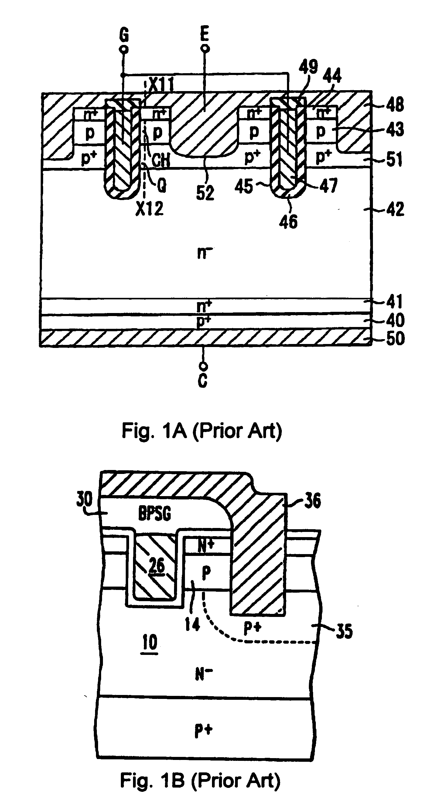 Trench insulated gate bipolar transistor (GBT) with improved emitter-base contacts and metal schemes
