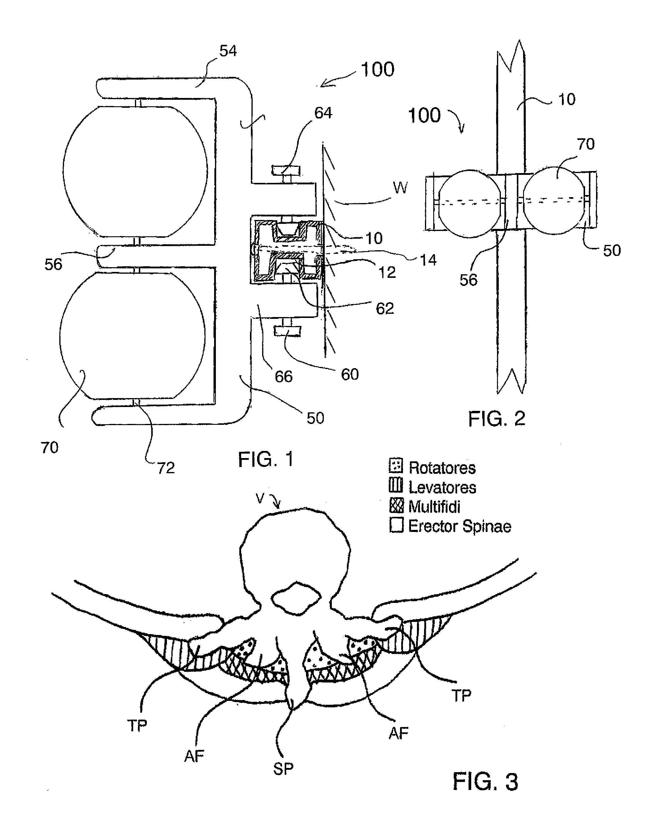 Massage Apparatus with Spherical Elements