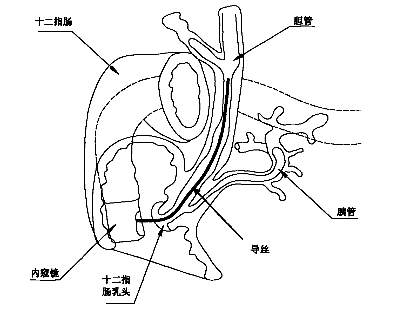 Bile duct puncturing needle