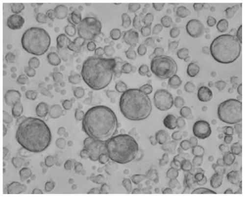 Preparation method, kit and application of male blood-derived autologous spermatogonial stem cells