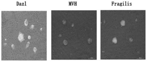 Preparation method, kit and application of male blood-derived autologous spermatogonial stem cells