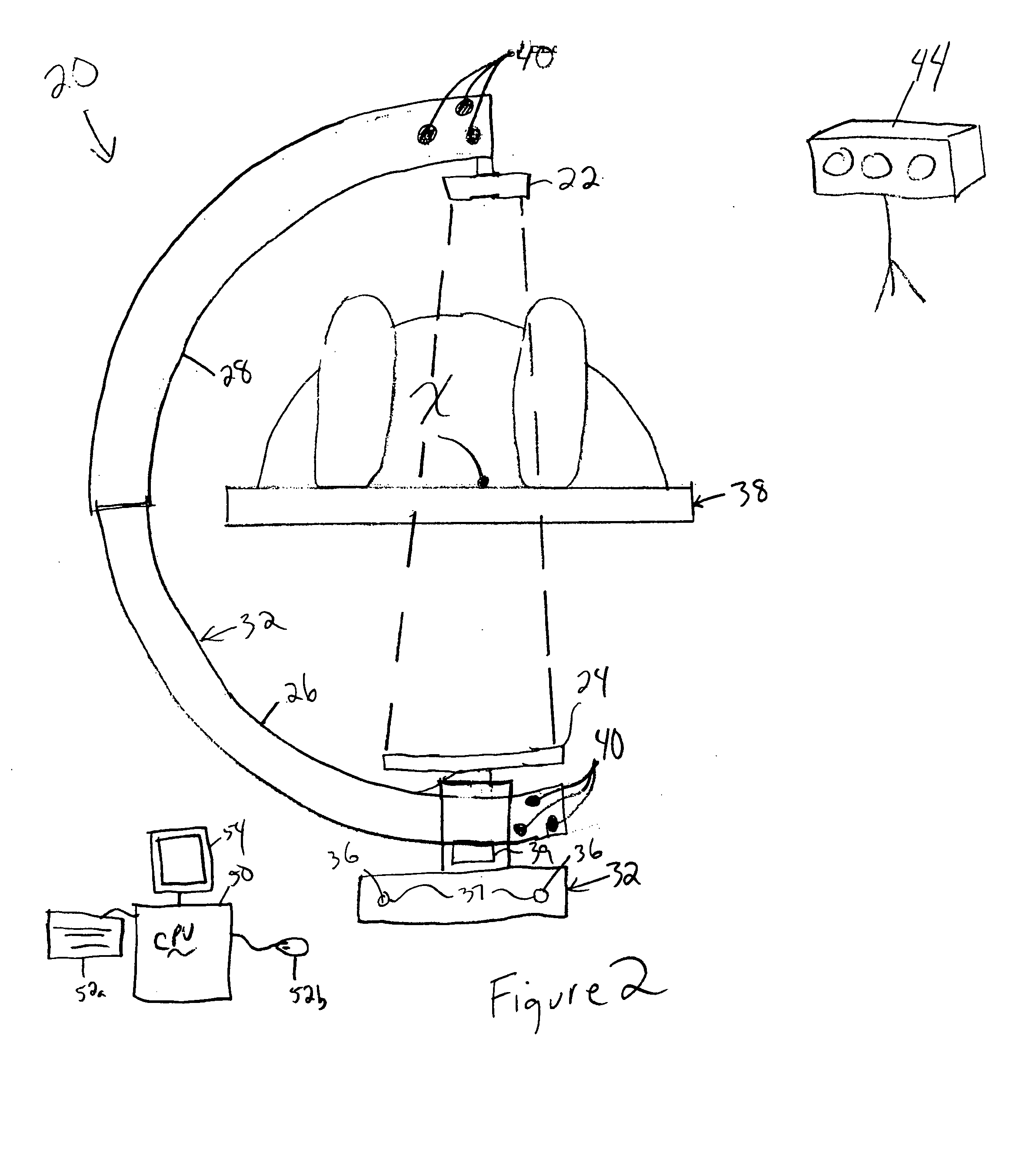 Intraoperative imaging system