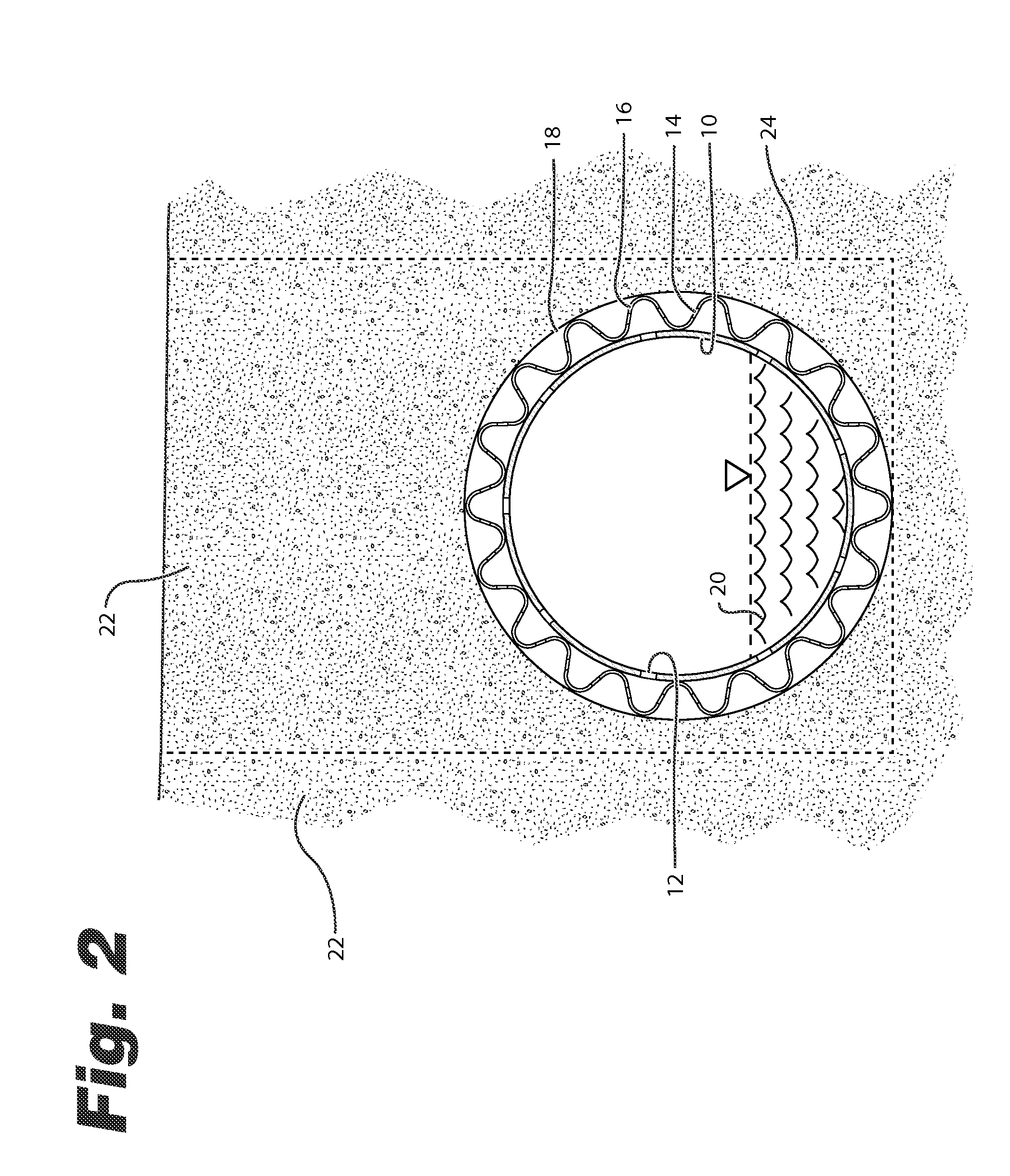 Soil drainage system