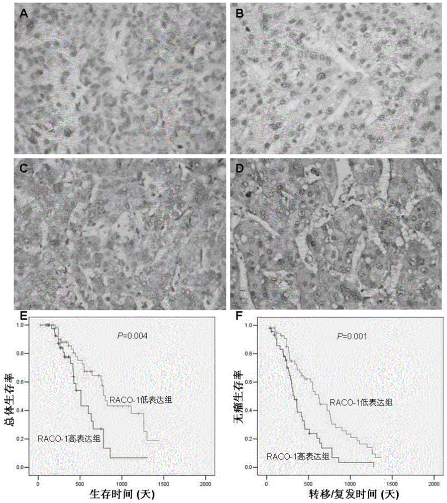 Drugs for treating liver cancer and application of raco-1 monoclonal antibody