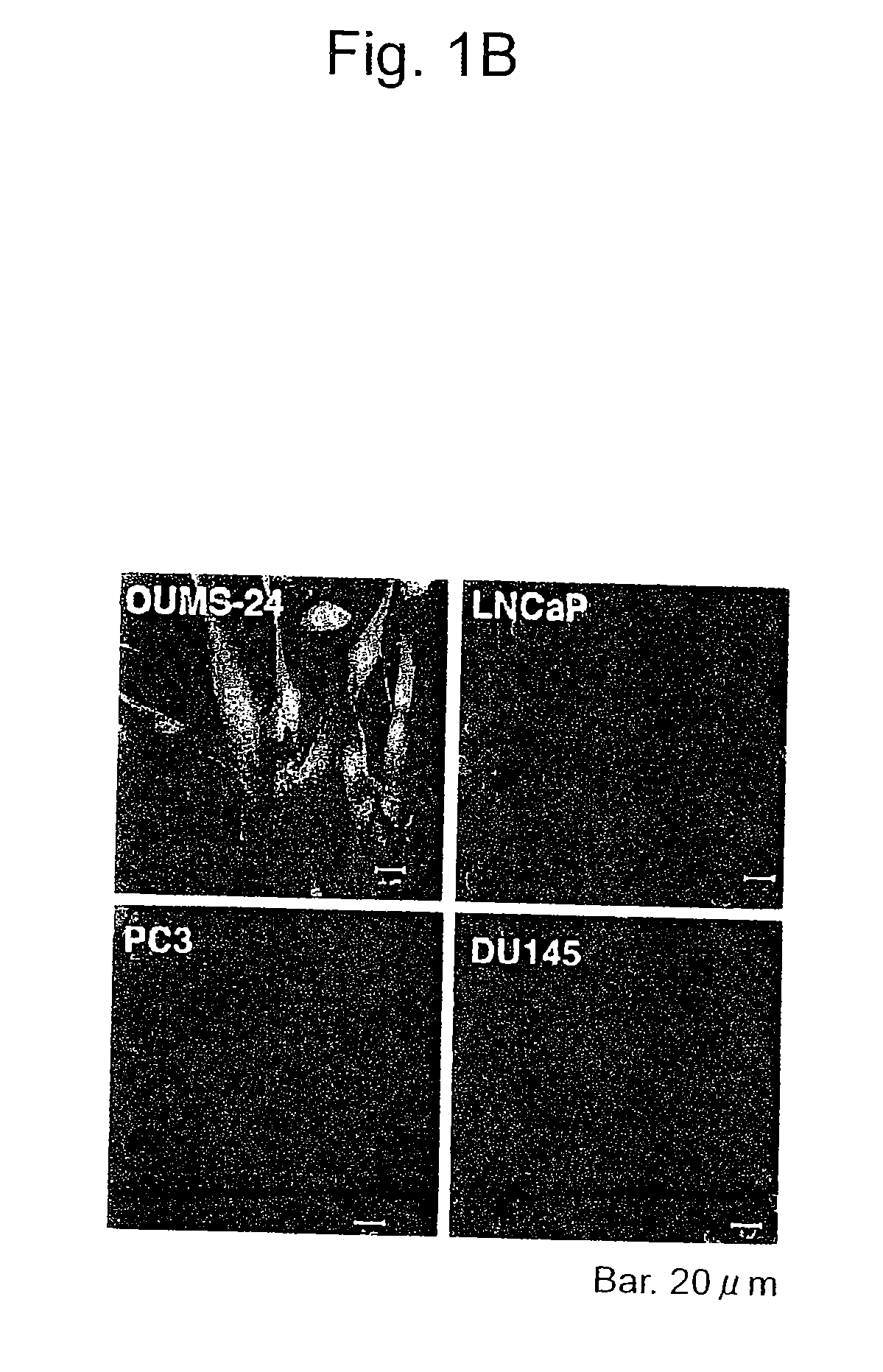 Apoptosis-inducing agent for prostate cancer cells