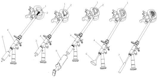 A fence-type endoscopic fusion device using absorbable material